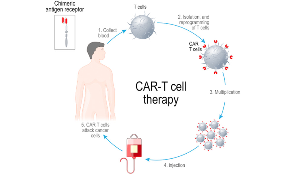 Proizvodnja CAR t-staničnog pripravka